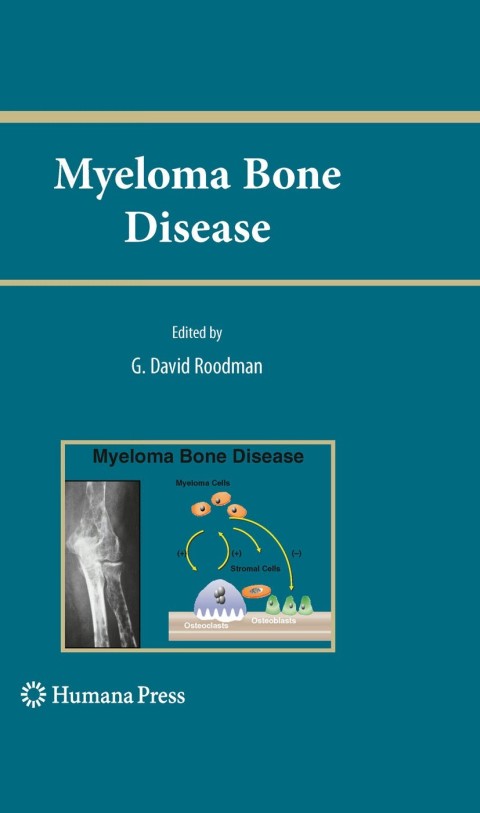 Cover image for book Myeloma Bone Disease