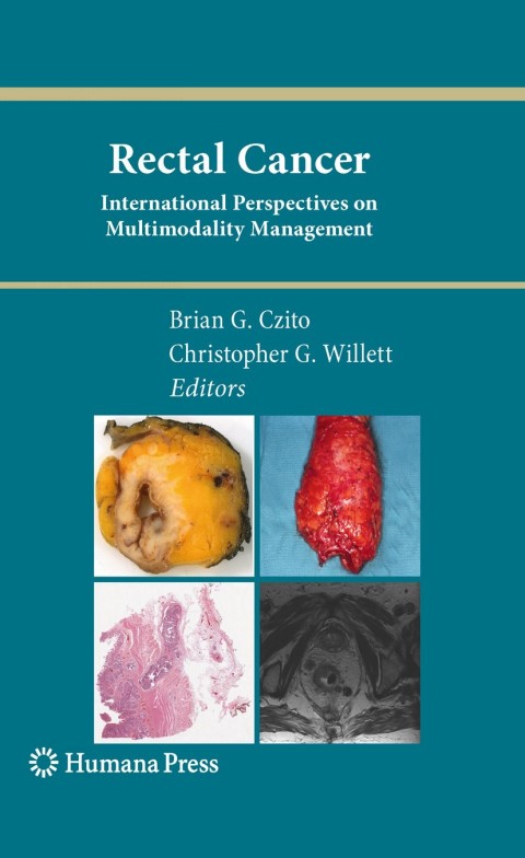 Cover image for book Rectal Cancer