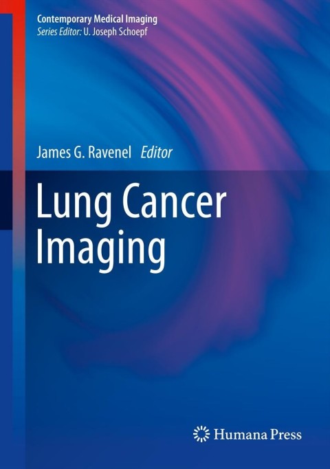 Cover image for book Lung Cancer Imaging