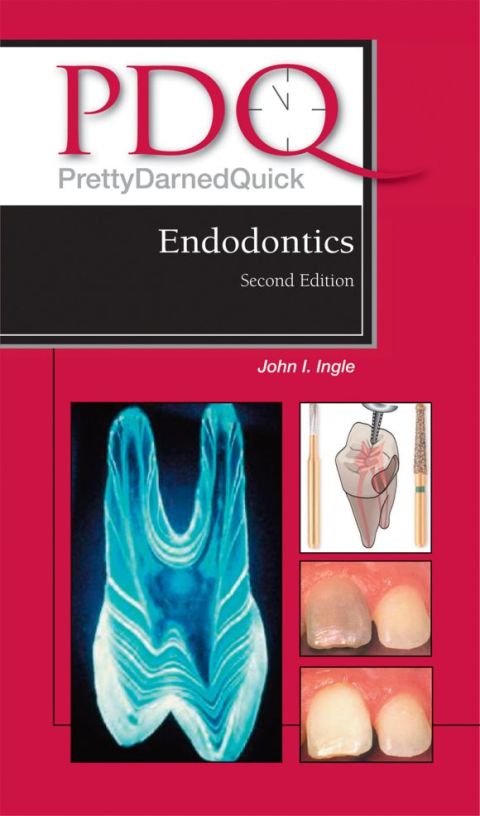 Cover image for book PDQ Endodontics