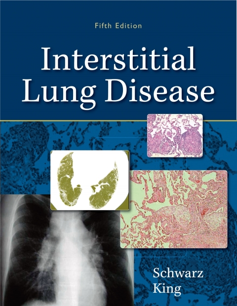 Cover image for book Interstitial Lung Disease
