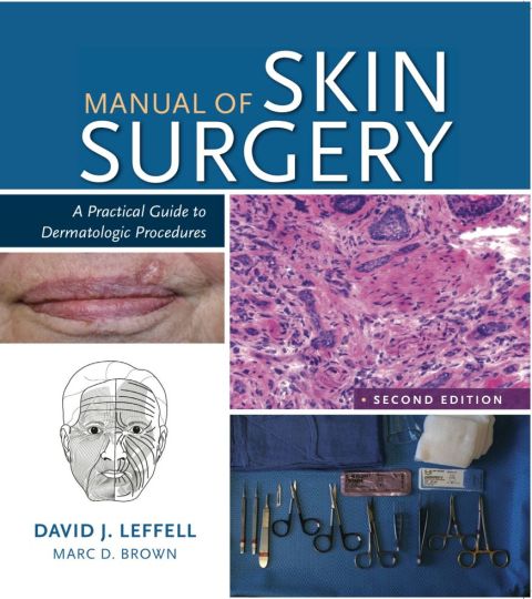 Cover image for book Manual of Skin Surgery
