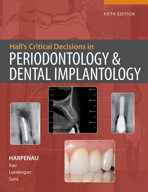 Cover image for book Hall's Critical Decisions in Periodontology & Dental Implantology, 5e