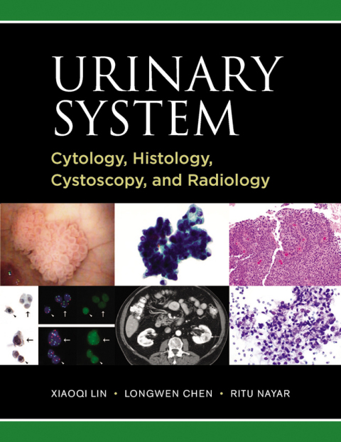 Cover image for book Urinary System: Cytology, Histology, Cystoscopy, and Radiology