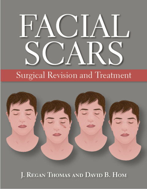 Cover image for book Facial Scars
