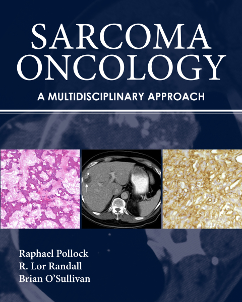Cover image for book Sarcoma Oncology