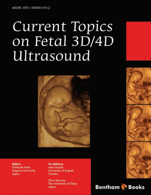 Cover image for book Current Topics on Fetal 3D/4D Ultrasound
