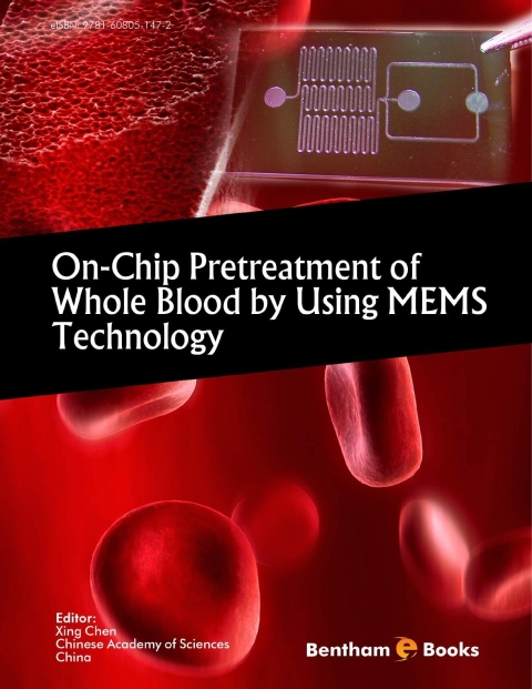 Cover image for book On-Chip Pretreatment of Whole Blood by Using MEMS Technology