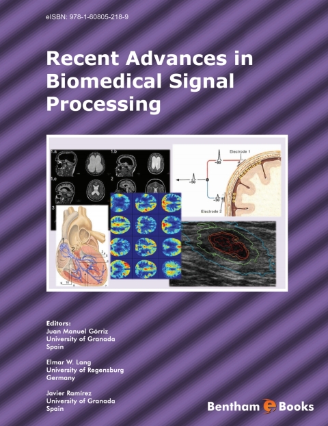 Cover image for book Recent Advances in Biomedical Signal Processing