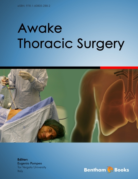 Cover image for book Awake Thoracic Surgery