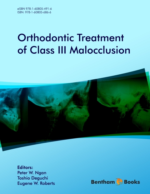 Cover image for book Orthodontic Treatment of Class III Malocclusion