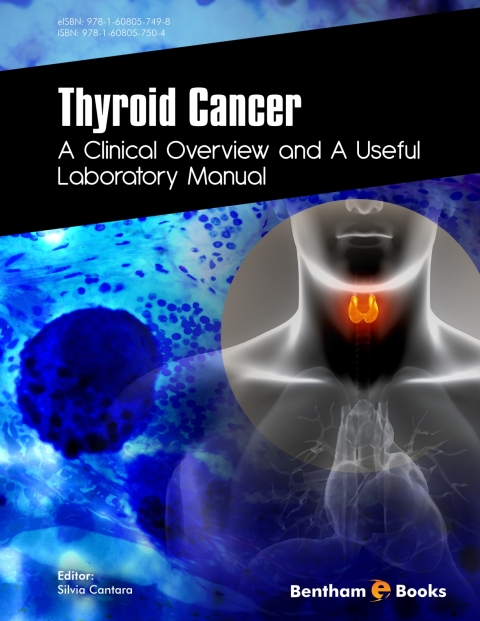 Cover image for book Thyroid Cancer: A Clinical Overview and a Useful Laboratory Manual