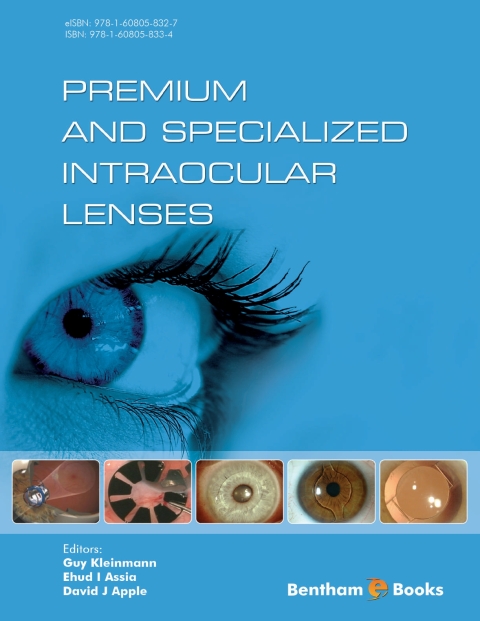 Cover image for book Premium and Specialized Intraocular Lenses
