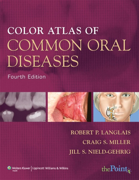 Cover image for book Color Atlas of Common Oral Diseases