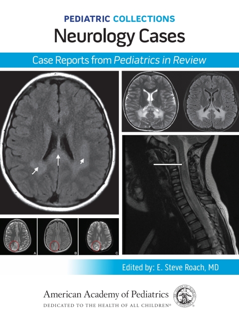 Cover image for book Pediatric Collections: Neurology Cases: Case Reports from Pediatrics in Review