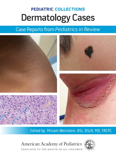 Cover image for book Pediatric Collections: Dermatology Cases: Case Reports from Pediatrics in Review