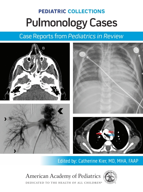 Cover image for book Pediatric Collections: Pulmonology Cases: Case Reports from Pediatrics in Review