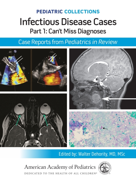 Cover image for book Pediatric Collections: Infectious Disease Cases: Part 1: Can’t Miss Diagnoses: Case Reports from Pediatrics in Review