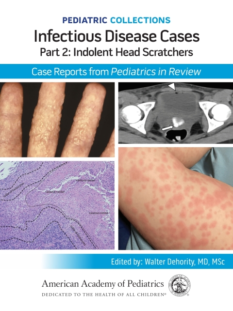 Cover image for book Pediatric Collections: Infectious Disease Cases: Part 2: Indolent Head Scratchers: Case Reports from Pediatrics in Review
