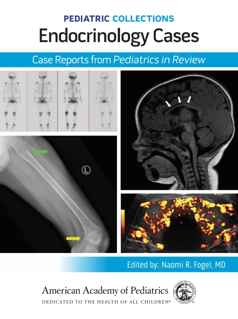 Cover image for book Pediatric Collections: Endocrinology Cases: Case Reports from Pediatrics in Review