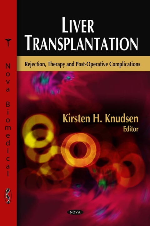 Cover image for book Liver Transplantation: Rejection, Therapy and Post-Operative Complications