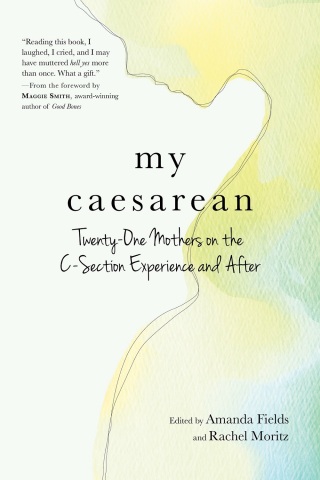 My Caesarean