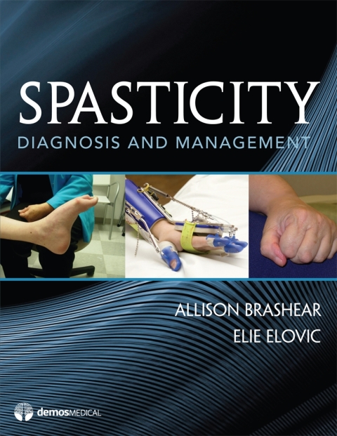 Cover image for book Spasticity