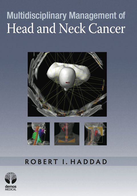 Cover image for book Multidisciplinary Management of Head and Neck Cancer
