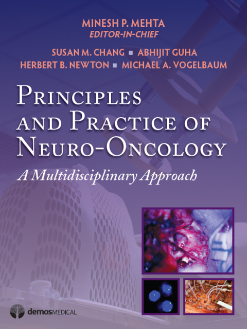Cover image for book Principles & Practice of Neuro-Oncology