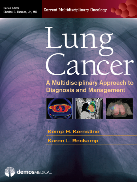 Cover image for book Lung Cancer