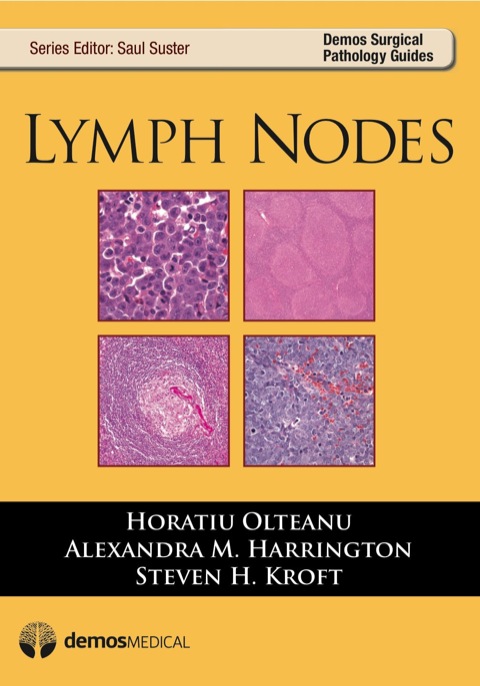 Cover image for book Lymph Nodes