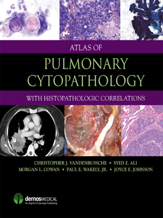 Atlas of Pulmonary Cytopathology