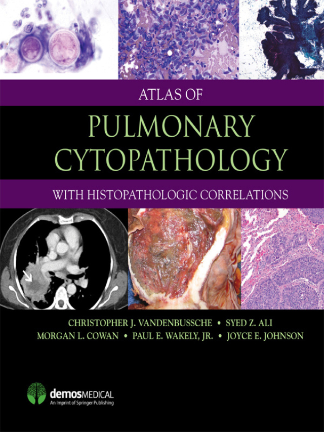 Atlas of Pulmonary Cytopathology