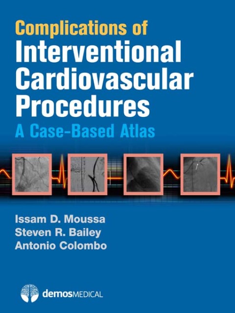 Complications of Interventional Cardiovascular Procedures 