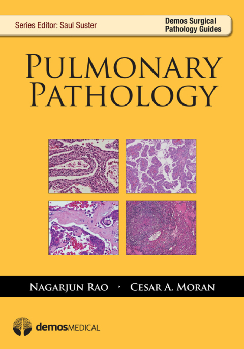 Cover image for book Pulmonary Pathology