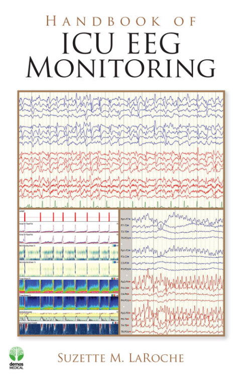 Cover image for book Handbook of ICU EEG Monitoring