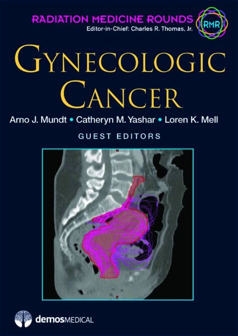 Cover image for book Gynecologic Cancer
