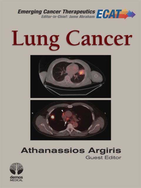 Cover image for book Lung Cancer