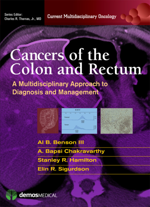 Cover image for book Cancers of the Colon and Rectum
