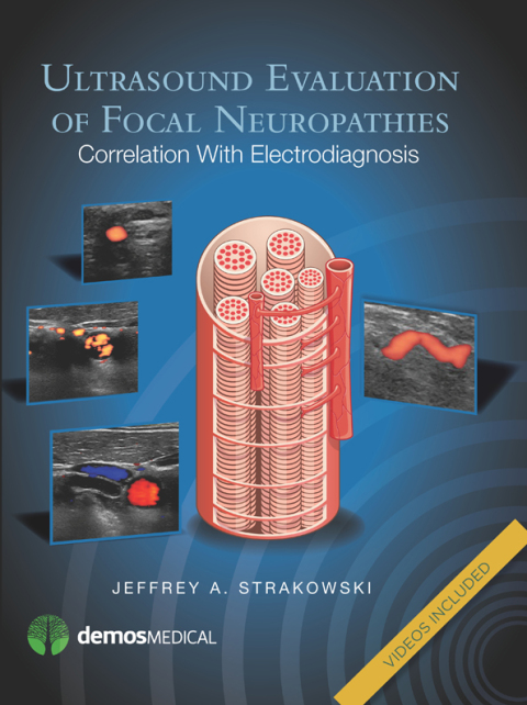 Cover image for book Ultrasound Evaluation of Focal Neuropathies