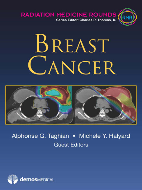 Cover image for book Breast Cancer
