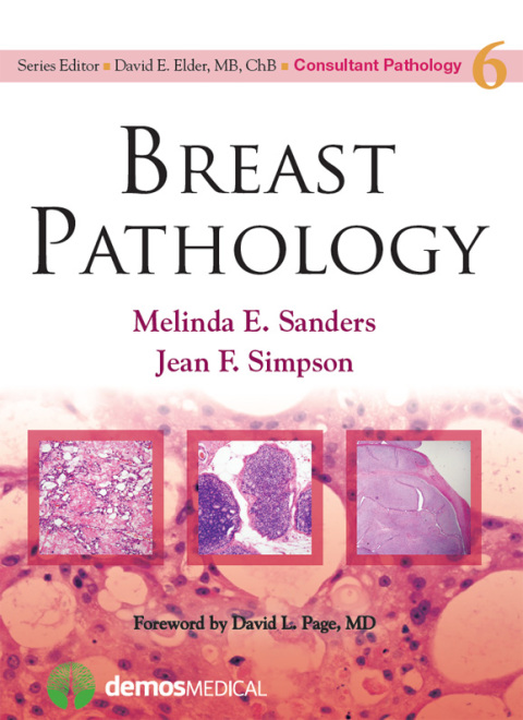 Cover image for book Breast Pathology