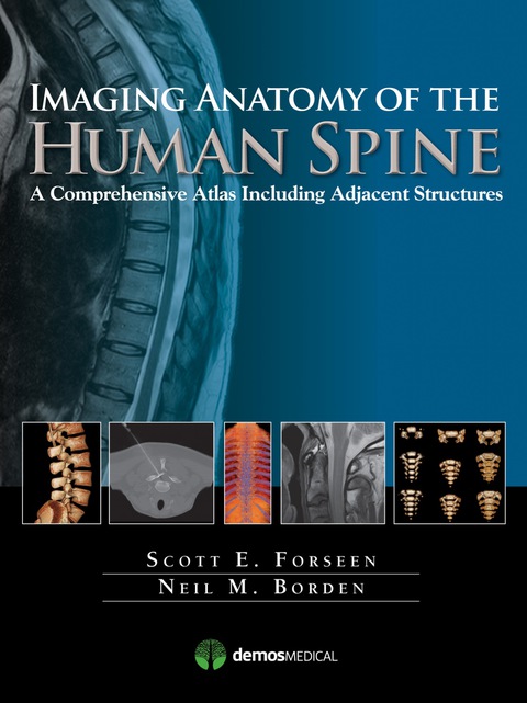Cover image for book Imaging Anatomy of the Human Spine