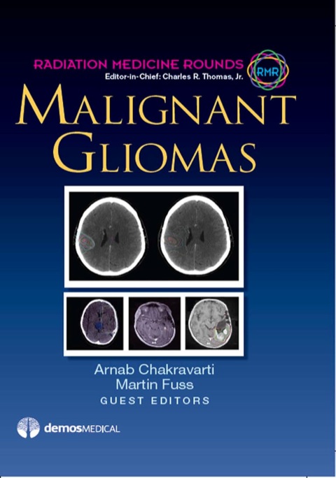 Cover image for book Malignant Gliomas