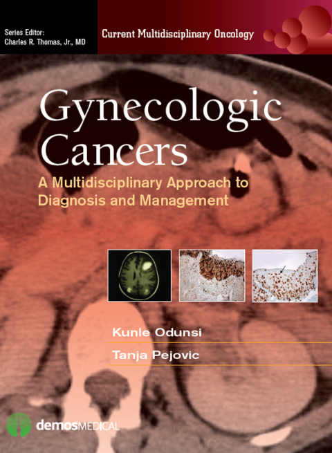 Cover image for book Gynecologic Cancers