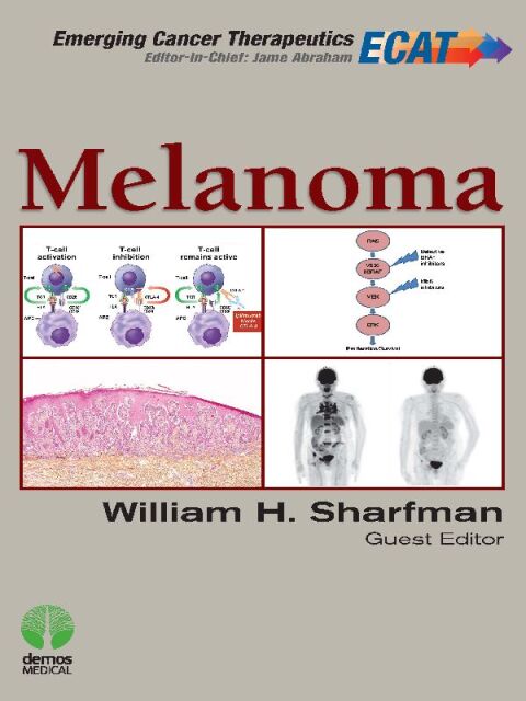 Cover image for book Melanoma