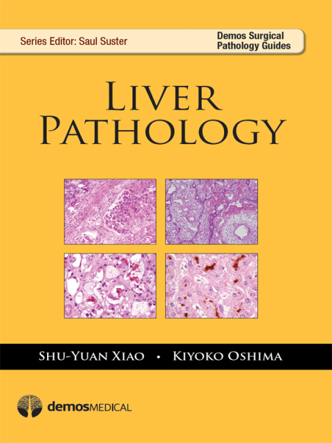 Cover image for book Liver Pathology