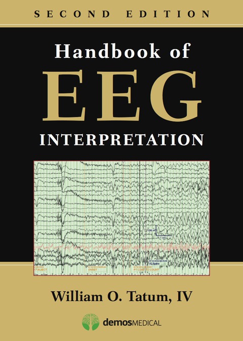 Handbook of EEG Interpretation 