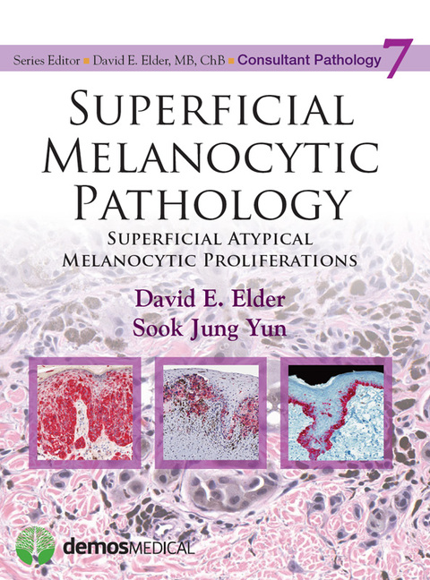 Superficial Melanocytic Pathology 