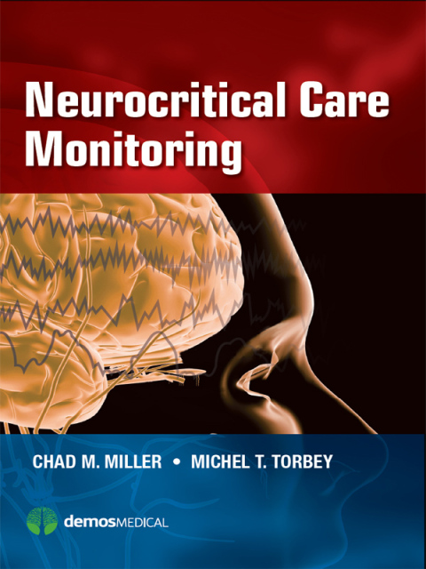 Cover image for book Neurocritical Care Monitoring